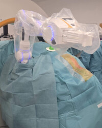 High-precision robotic navigation supports accurate spinal procedures. Robotic navigation system used during spine surgery