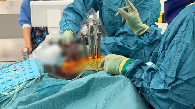 Intraoperative spinal screw insertion using surgical guidance Intraoperative spinal screw insertion using surgical guidance