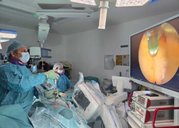 Minimally invasive spine surgery using endoscope to treat nerve compression